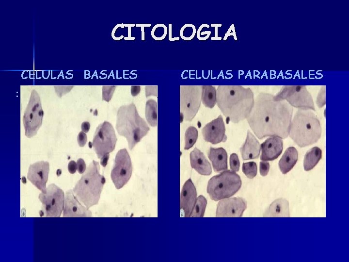 CITOLOGIA CELULAS BASALES : CELULAS PARABASALES 