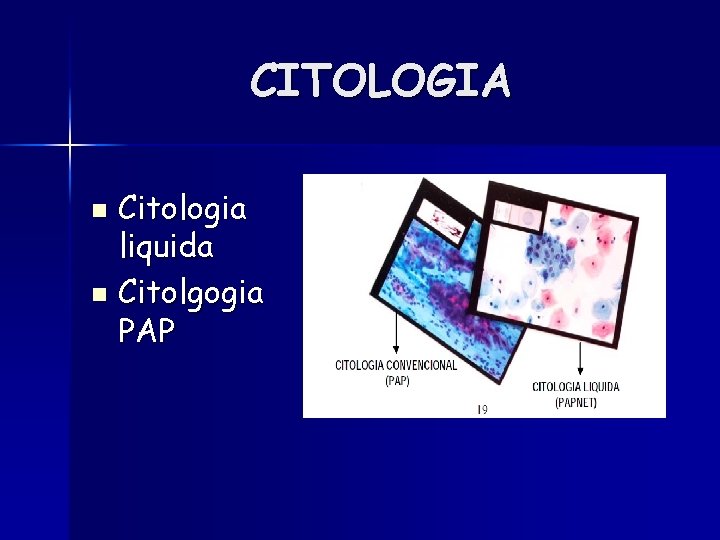 CITOLOGIA Citologia liquida n Citolgogia PAP n 