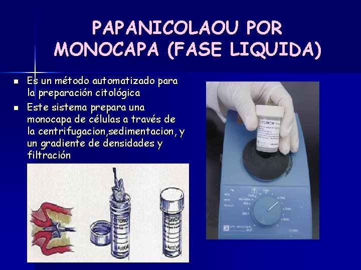 PAPANICOLAOU POR MONOCAPA (FASE LIQUIDA) n n Es un método automatizado para la preparación