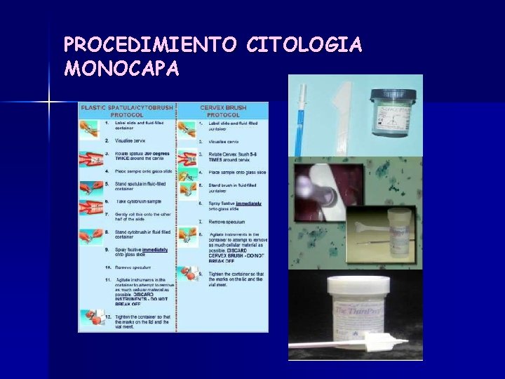 PROCEDIMIENTO CITOLOGIA MONOCAPA 