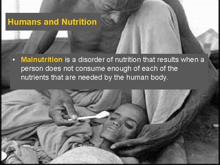 Humans and Nutrition • Malnutrition is a disorder of nutrition that results when a