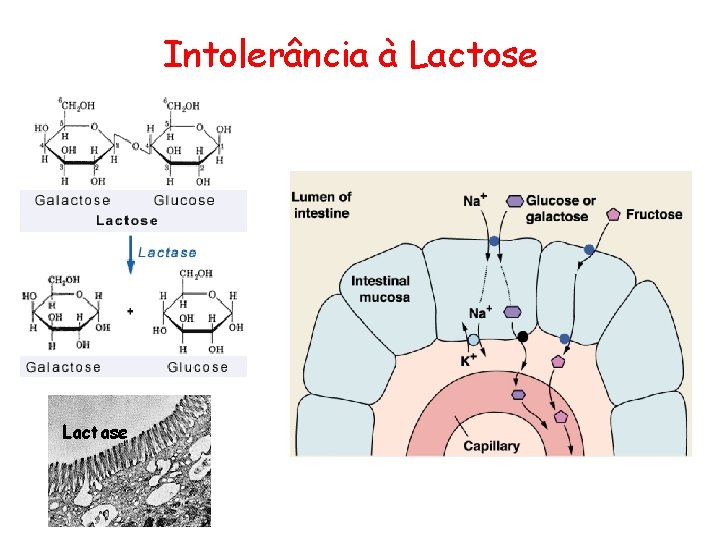 Intolerância à Lactose Lactase 