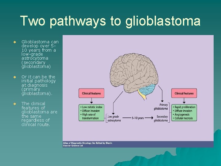 Two pathways to glioblastoma u Glioblastoma can develop over 510 years from a low-grade