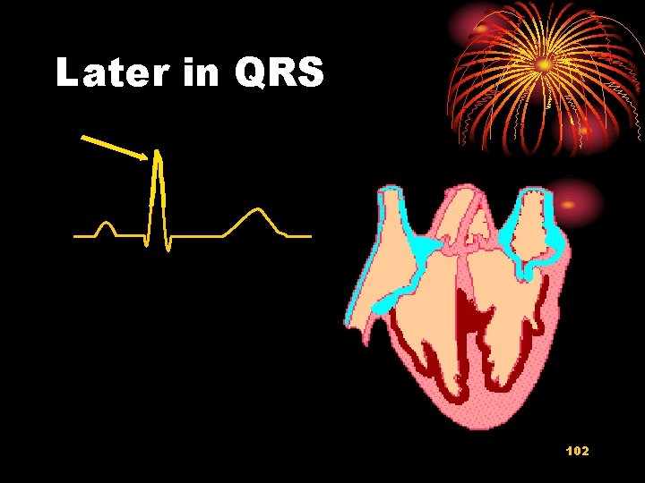 Later in QRS 102 