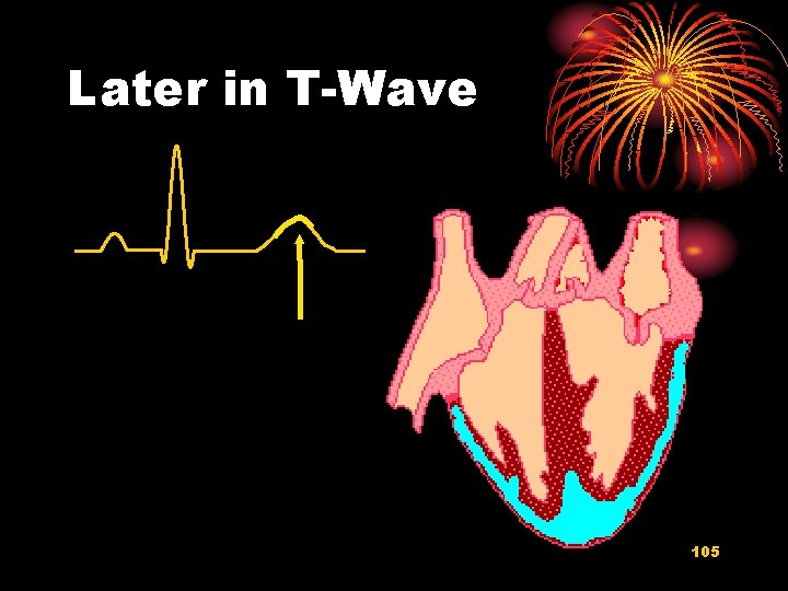 Later in T-Wave 105 