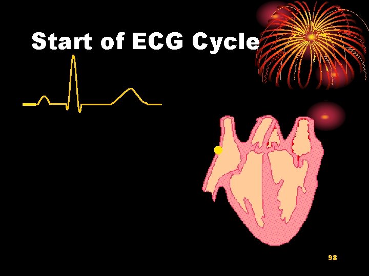 Start of ECG Cycle 98 