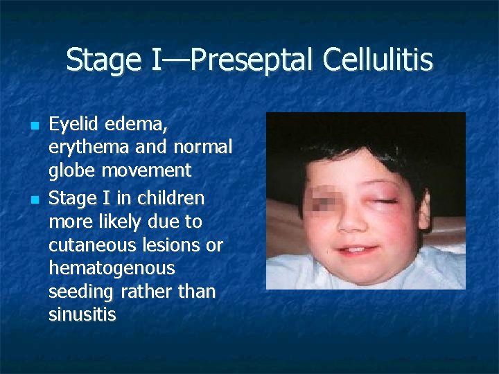 Stage I—Preseptal Cellulitis Eyelid edema, erythema and normal globe movement Stage I in children