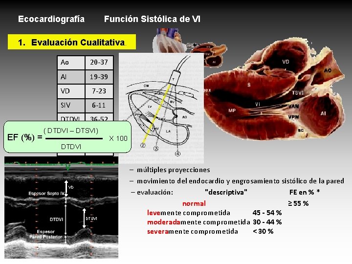 Ecocardiografía Función Sistólica de VI 1. Evaluación Cualitativa. EF (%) = Ao 20 -37 Ecocardiografía Función Sistólica de VI 1. Evaluación Cualitativa. EF (%) = Ao 20 -37
