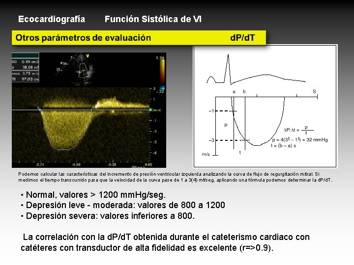 Ecocardiografía Función Sistólica de VI Podemos calcular las características del incremento de presión ventricular Ecocardiografía Función Sistólica de VI Podemos calcular las características del incremento de presión ventricular