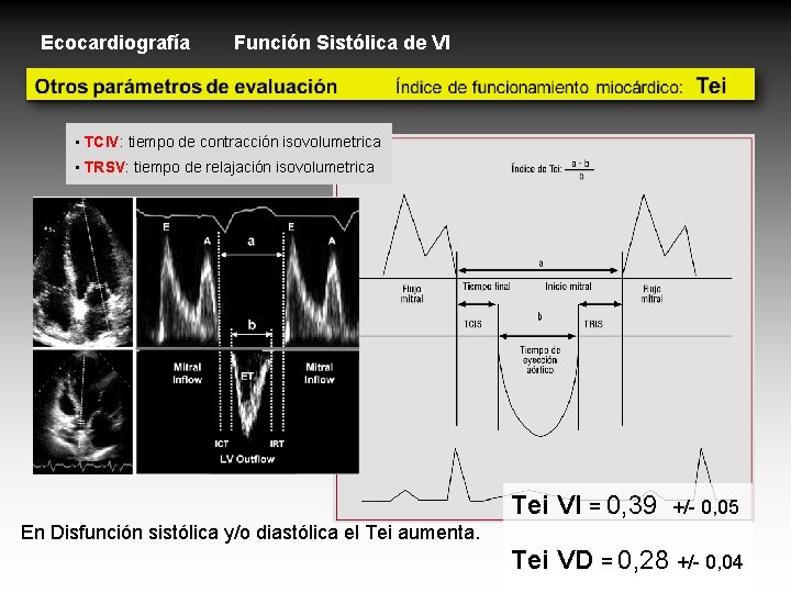 Ecocardiografía Función Sistólica de VI • TCIV: tiempo de contracción isovolumetrica • TRSV: tiempo Ecocardiografía Función Sistólica de VI • TCIV: tiempo de contracción isovolumetrica • TRSV: tiempo