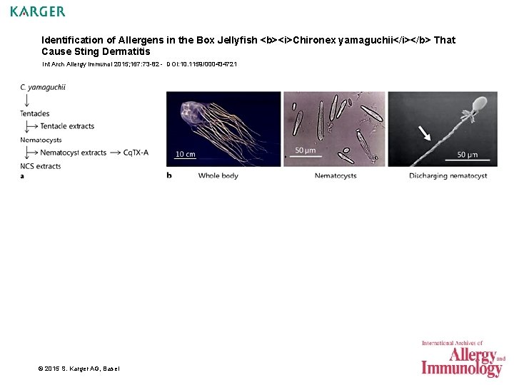 Identification of Allergens in the Box Jellyfish <b><i>Chironex yamaguchii</i></b> That Cause Sting Dermatitis Int