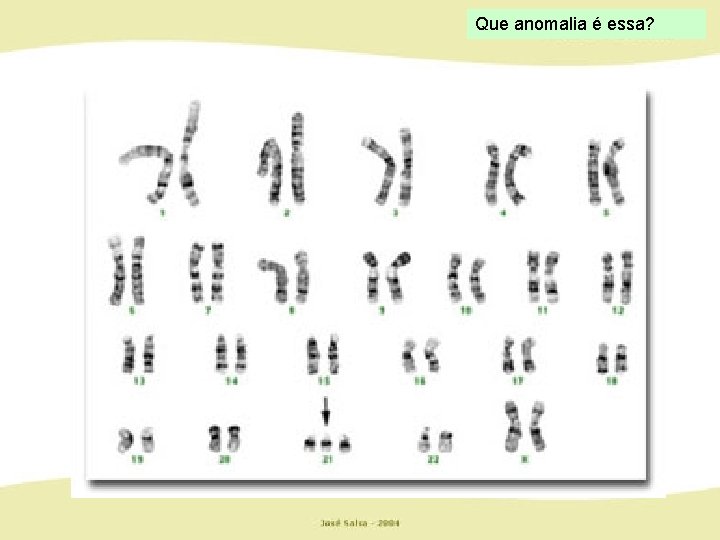 Que anomalia é essa? 