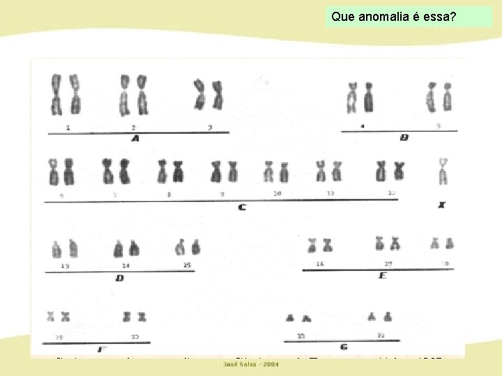 Que anomalia é essa? 