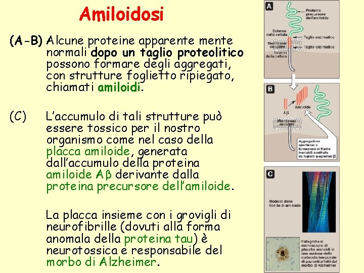 Amiloidosi (A-B) Alcune proteine apparente mente normali dopo un taglio proteolitico possono formare degli