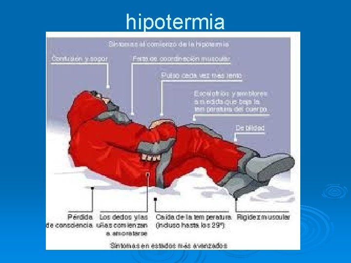 hipotermia 