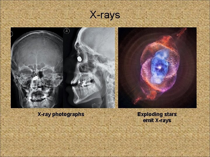 X-rays X-ray photographs Exploding stars emit X-rays 