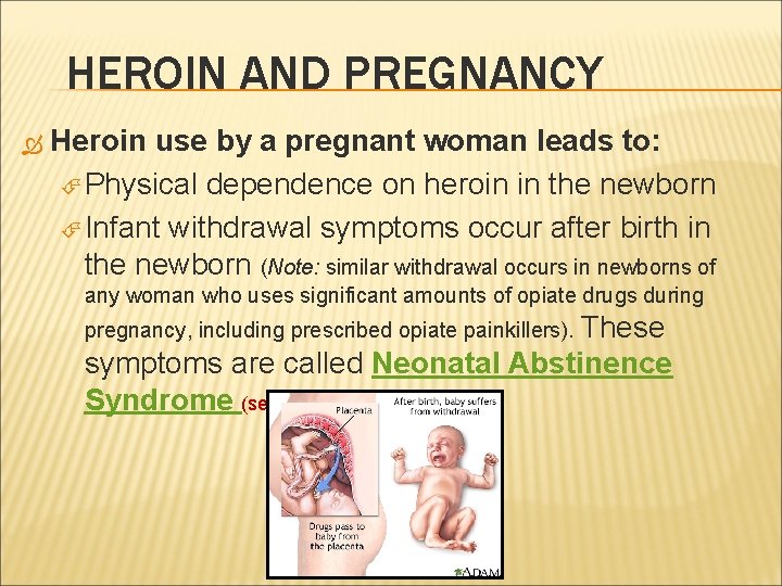 HEROIN AND PREGNANCY Heroin use by a pregnant woman leads to: Physical dependence on