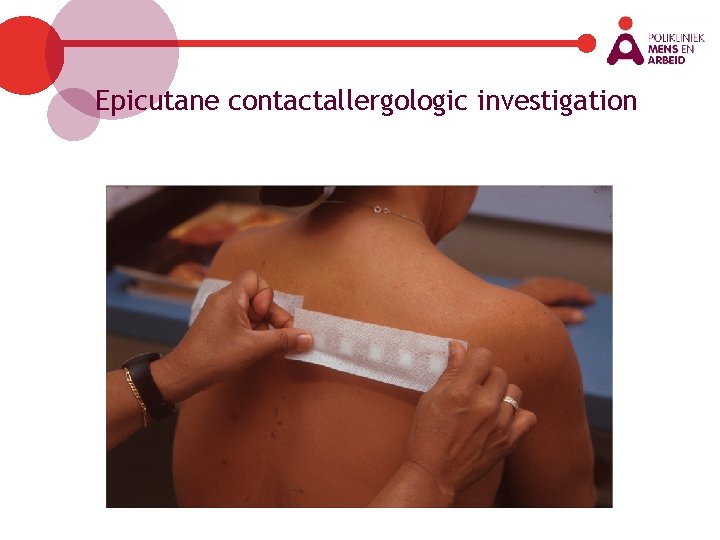 Epicutane contactallergologic investigation 