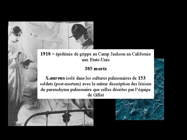 1918 = épidémie de grippe au Camp Jackson en Californie aux Etats-Unis 385 morts