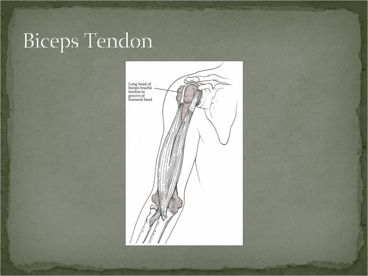 Biceps Tendon 