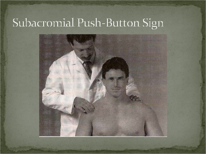 Subacromial Push-Button Sign 