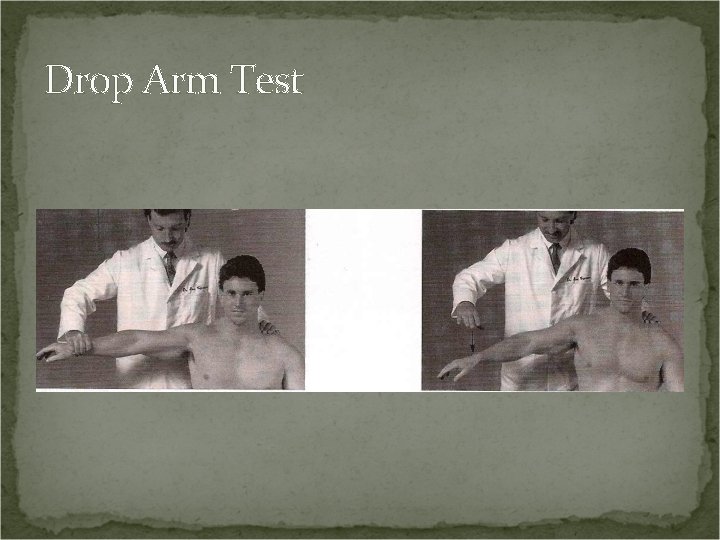 Drop Arm Test 