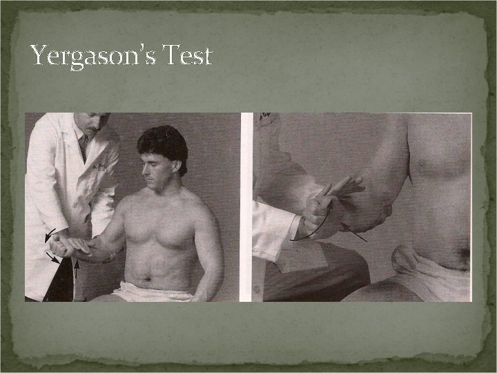 Yergason’s Test 