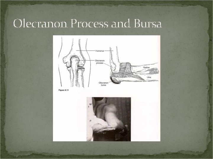 Olecranon Process and Bursa 