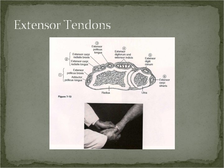 Extensor Tendons 