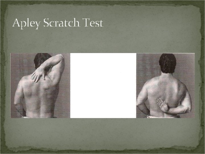 Apley Scratch Test 