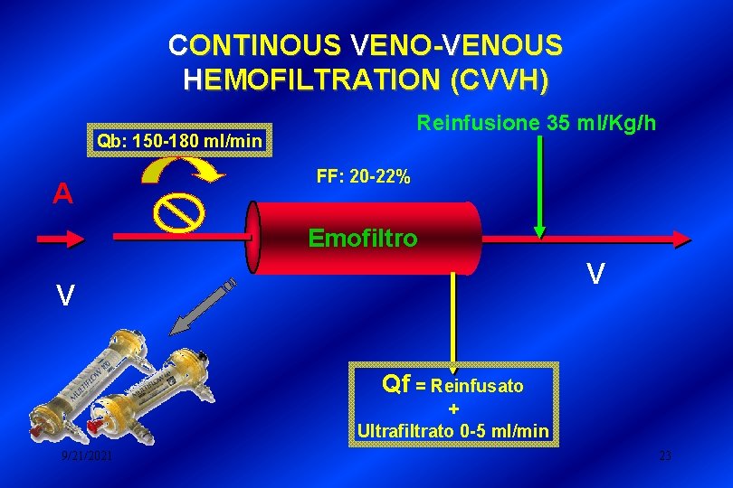 CONTINOUS VENO-VENOUS HEMOFILTRATION (CVVH) Reinfusione 35 ml/Kg/h Qb: 150 -180 ml/min A FF: 20