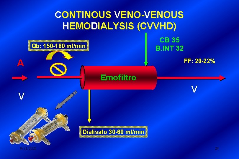 CONTINOUS VENO-VENOUS HEMODIALYSIS (CVVHD) CB 35 B. INT 32 Qb: 150 -180 ml/min FF: