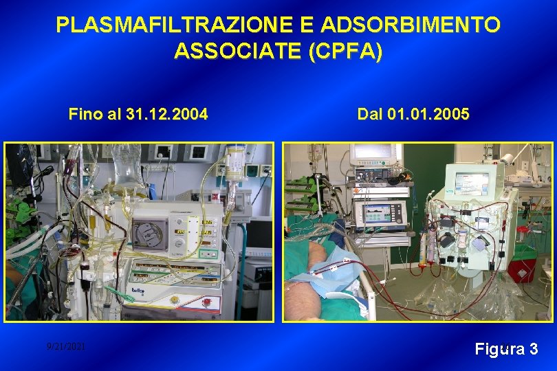 PLASMAFILTRAZIONE E ADSORBIMENTO ASSOCIATE (CPFA) Fino al 31. 12. 2004 9/21/2021 Dal 01. 2005