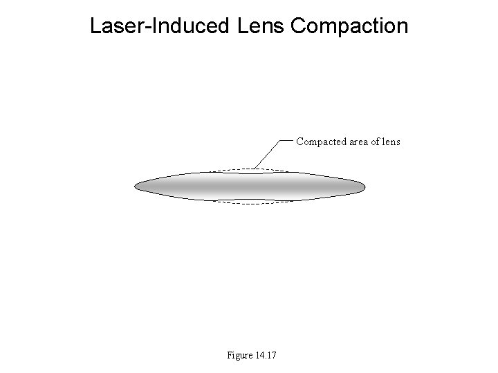 Laser-Induced Lens Compaction Compacted area of lens Figure 14. 17 