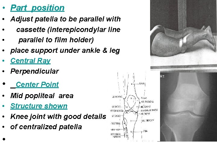  • Part position • • • Adjust patella to be parallel with cassette
