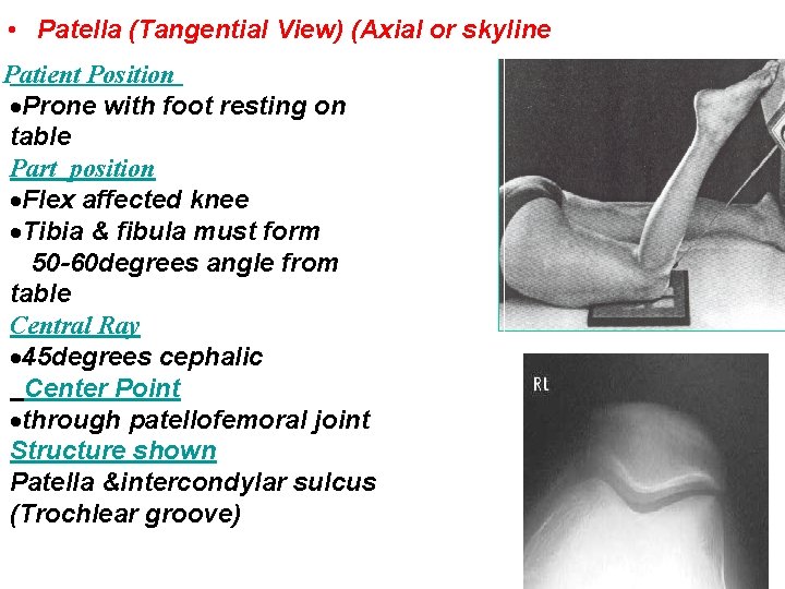  • Patella (Tangential View) (Axial or skyline Patient Position Prone with foot resting
