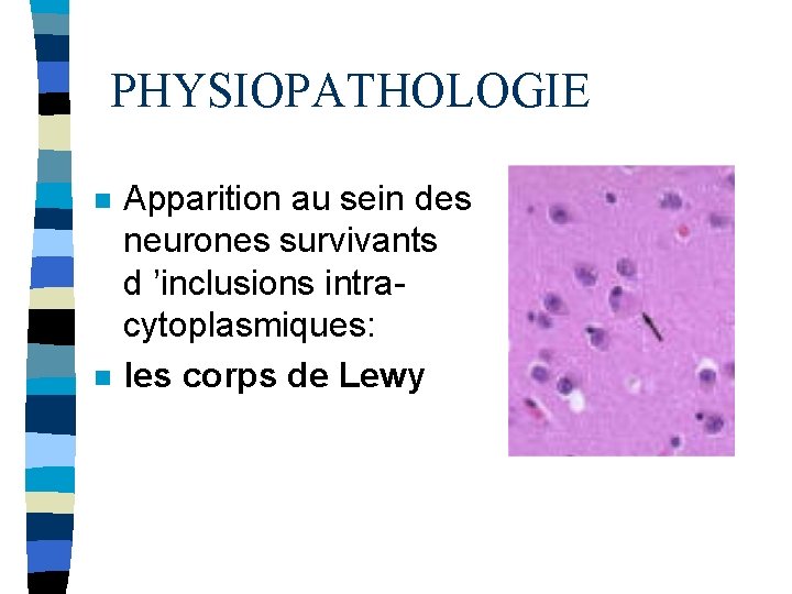 PHYSIOPATHOLOGIE n n Apparition au sein des neurones survivants d ’inclusions intracytoplasmiques: les corps