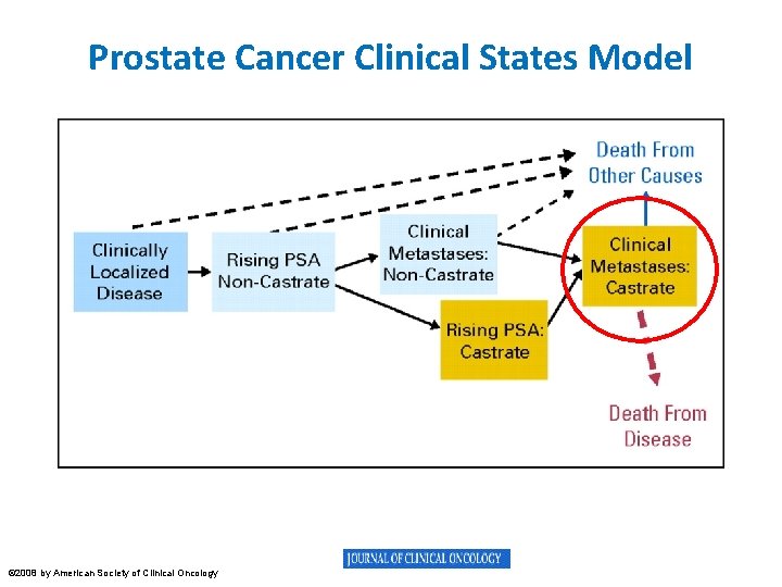 Prostate Cancer Clinical States Model Scher H I et al. JCO 2008; 26: 1148