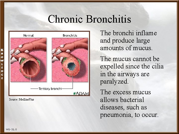 Chronic Bronchitis The bronchi inflame and produce large amounts of mucus. The mucus cannot