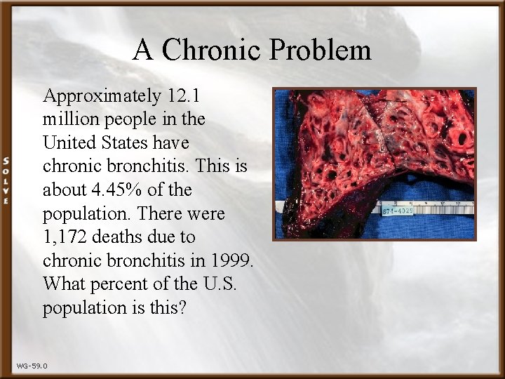 A Chronic Problem Approximately 12. 1 million people in the United States have chronic