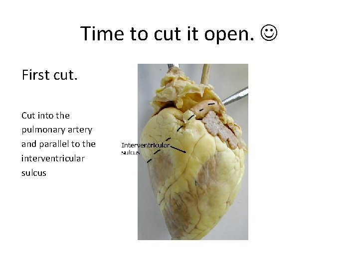 Time to cut it open. First cut. Cut into the pulmonary artery and parallel