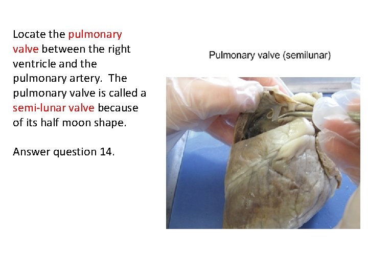 Locate the pulmonary valve between the right ventricle and the pulmonary artery. The pulmonary