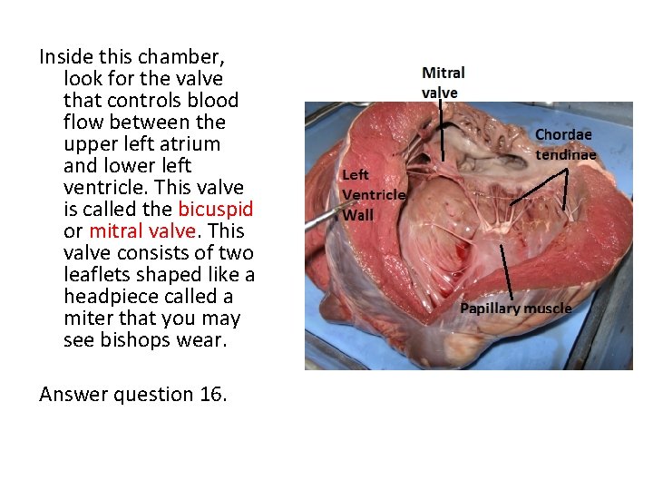 Inside this chamber, look for the valve that controls blood flow between the upper