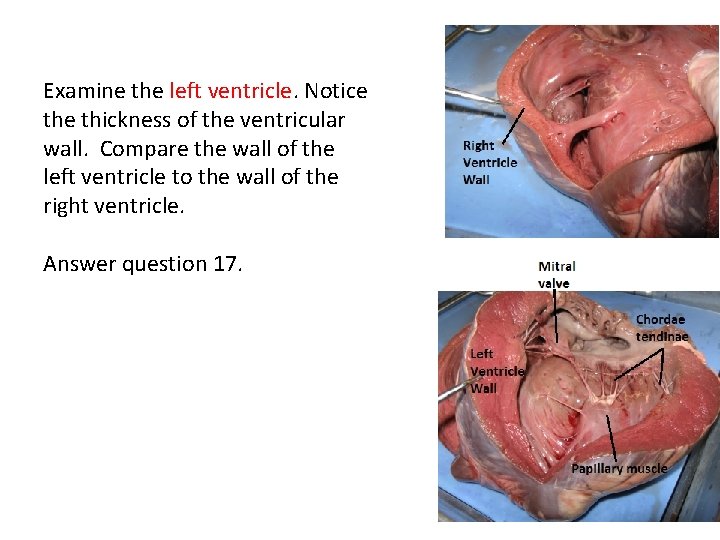 Examine the left ventricle. Notice thickness of the ventricular wall. Compare the wall of