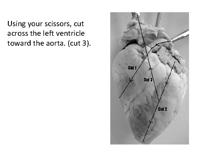 Using your scissors, cut across the left ventricle toward the aorta. (cut 3). 