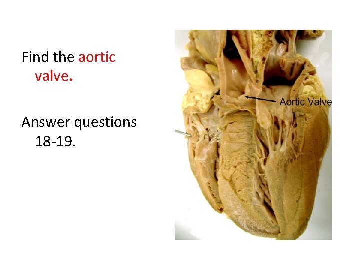 Find the aortic valve. Answer questions 18 -19. 