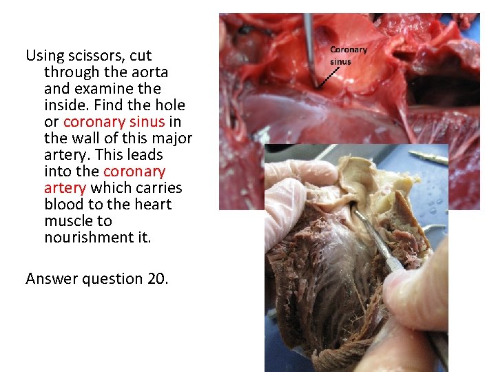 Using scissors, cut through the aorta and examine the inside. Find the hole or
