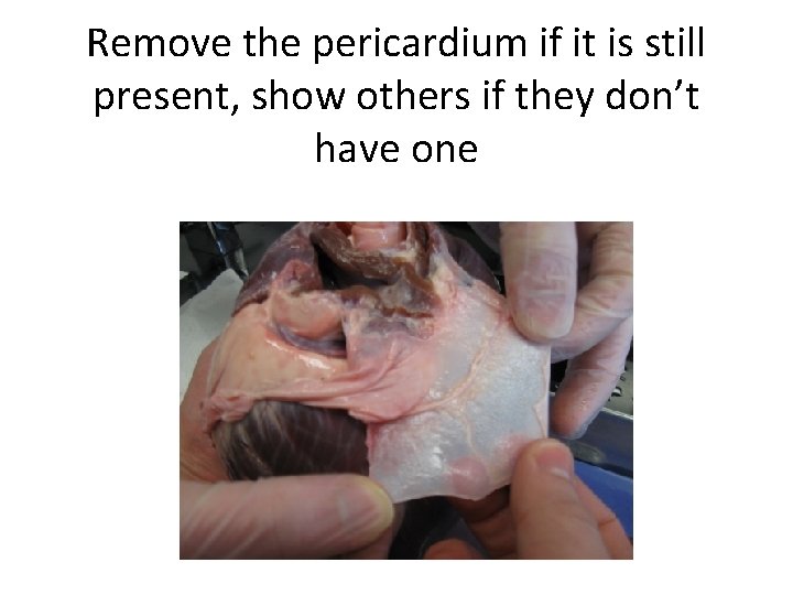 Remove the pericardium if it is still present, show others if they don’t have