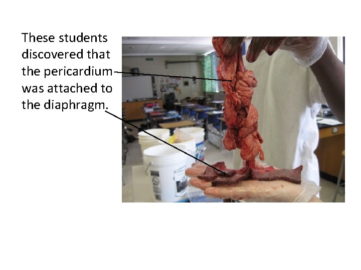 These students discovered that the pericardium was attached to the diaphragm. 