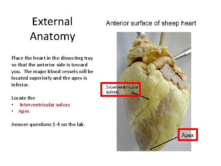 External Anatomy Place the heart in the dissecting tray so that the anterior side